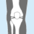 人口膝関節などの圧力分布測定