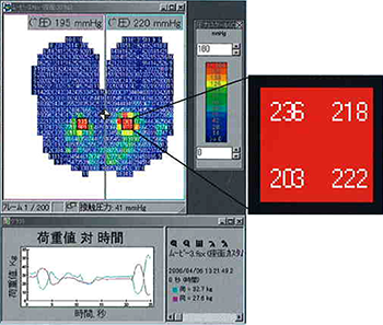 専用ソフトウェアから見た圧力分布の表示例