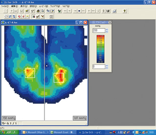 専用ソフトウェアから見た圧力分布の表示例